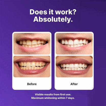 Purple Whitening Strips